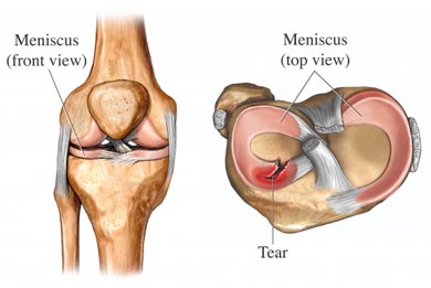 meniscus
