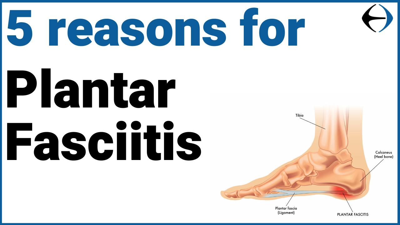 5_reasons_for_plantar_fasciitis