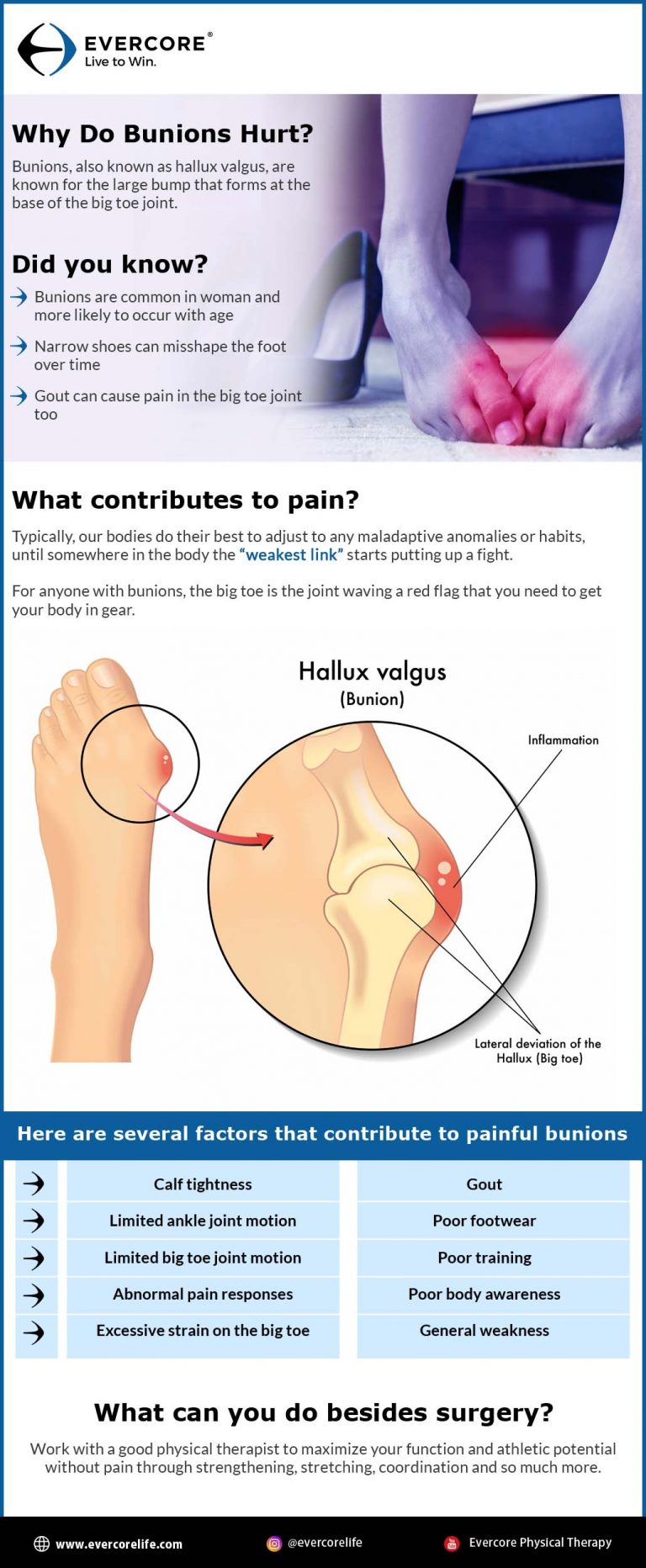 Why Do Bunions Hurt? Evercore Move With a Strong, Healthy Body