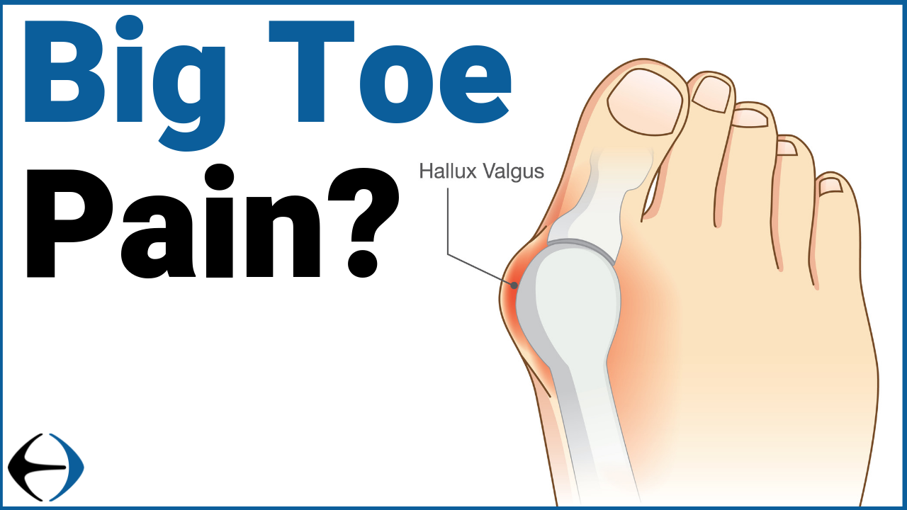 big_toe_pain_thumbnail