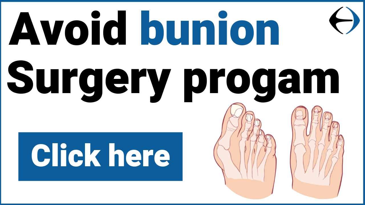 Avoid bunion surgery program - Evercore - Move With a Strong, Healthy Body