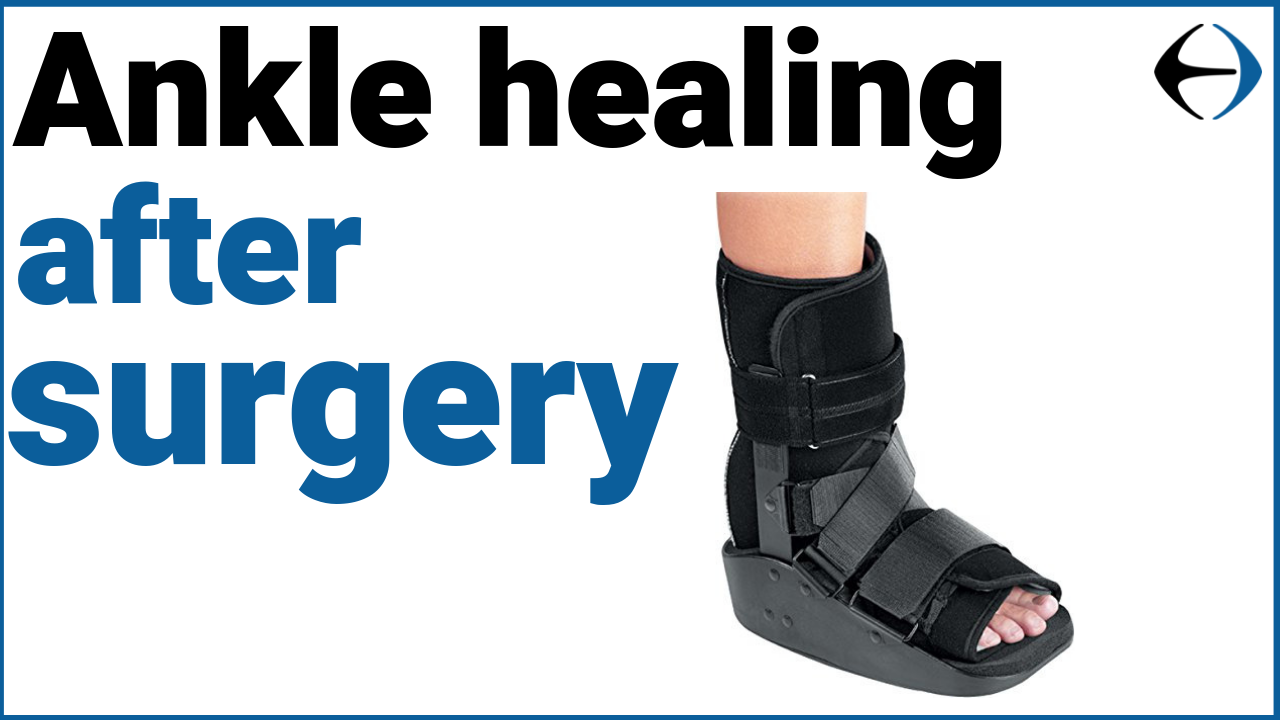 ankle_healing_thumbnail